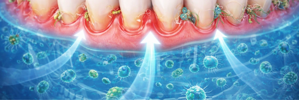 gum_disease_supplement