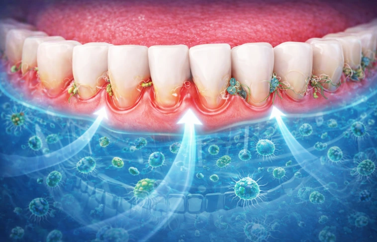 gum_disease_supplement_2